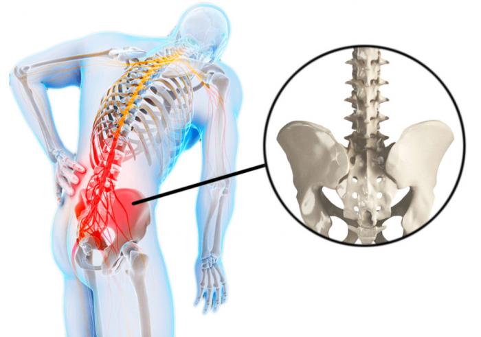 Боль в пояснице у женщин лечение - причины, лечение